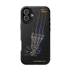 MEC™ The Claw Phone Cases
