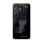 MEC™ The Claw Phone Cases