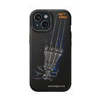 MEC™ The Claw Phone Cases