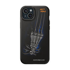MEC™ The Claw Phone Cases