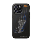 MEC™ The Claw Phone Cases