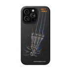 MEC™ The Claw Phone Cases